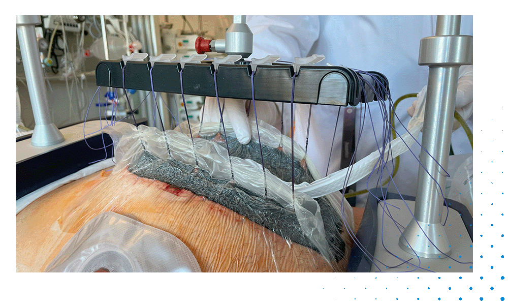 Case Report Abdomen_Videopreview_Device