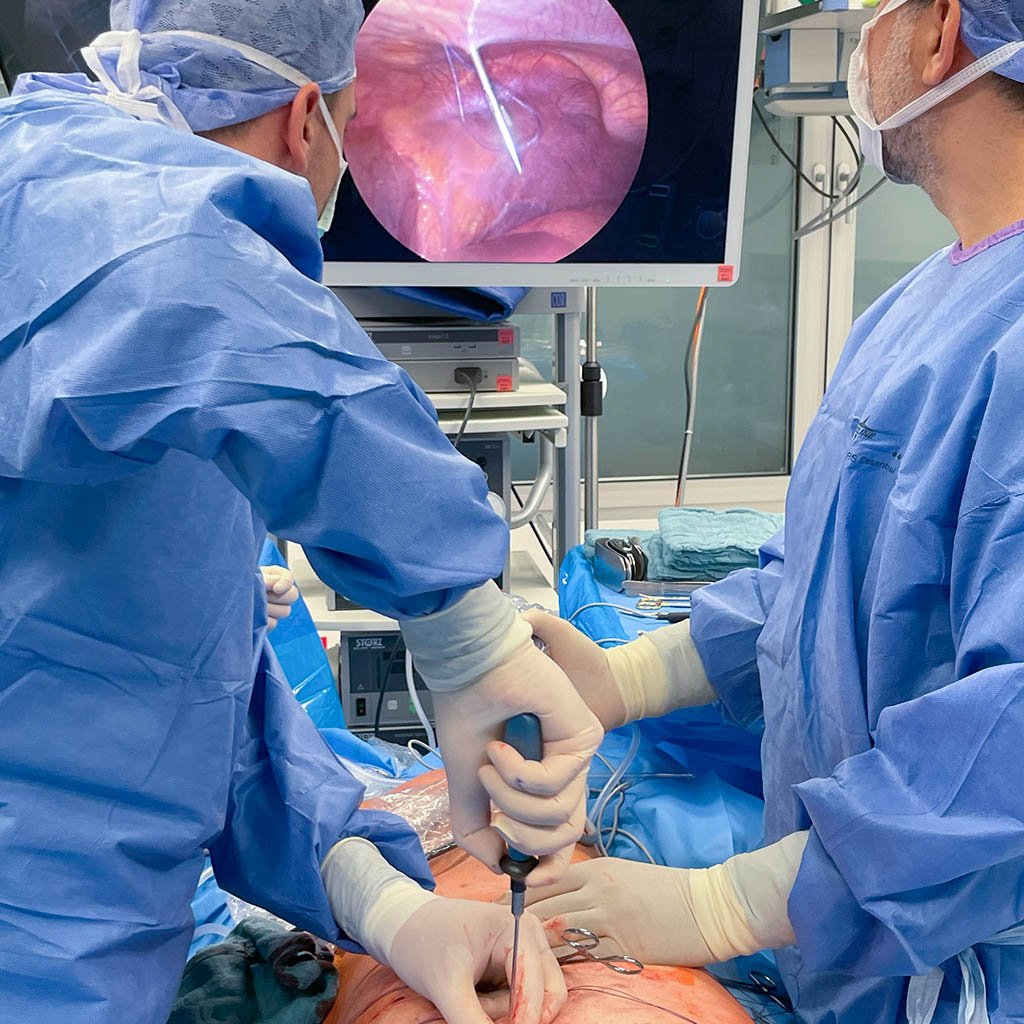Giant scrotal hernia_laparoscopic application