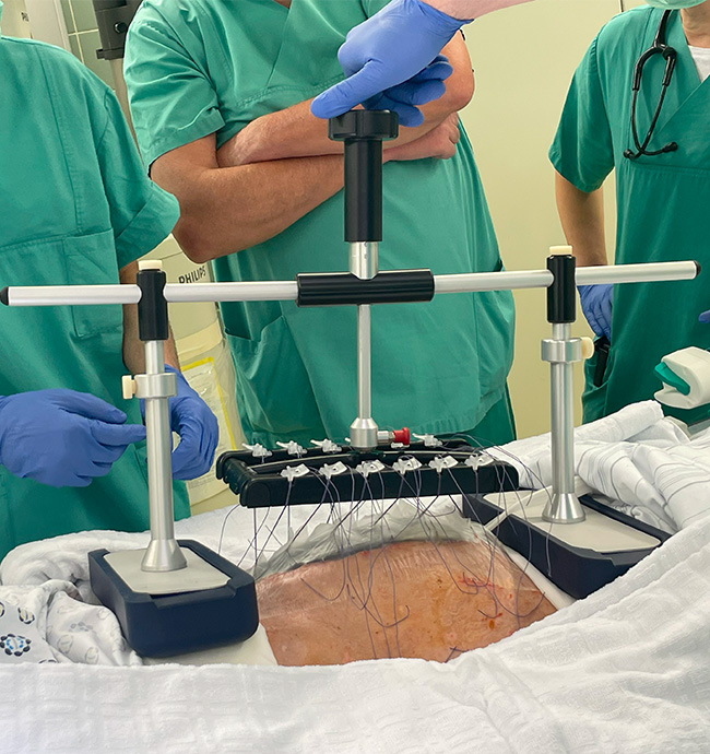 Abdomen_Application2_650x690