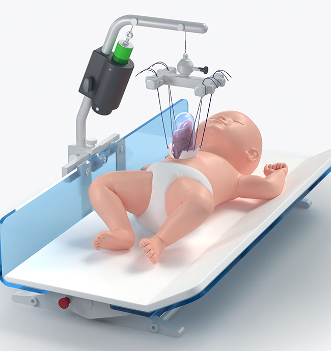 Pediatric Device