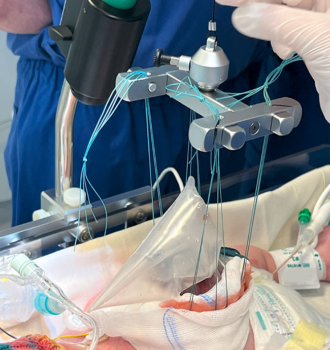 Pediatric Application
