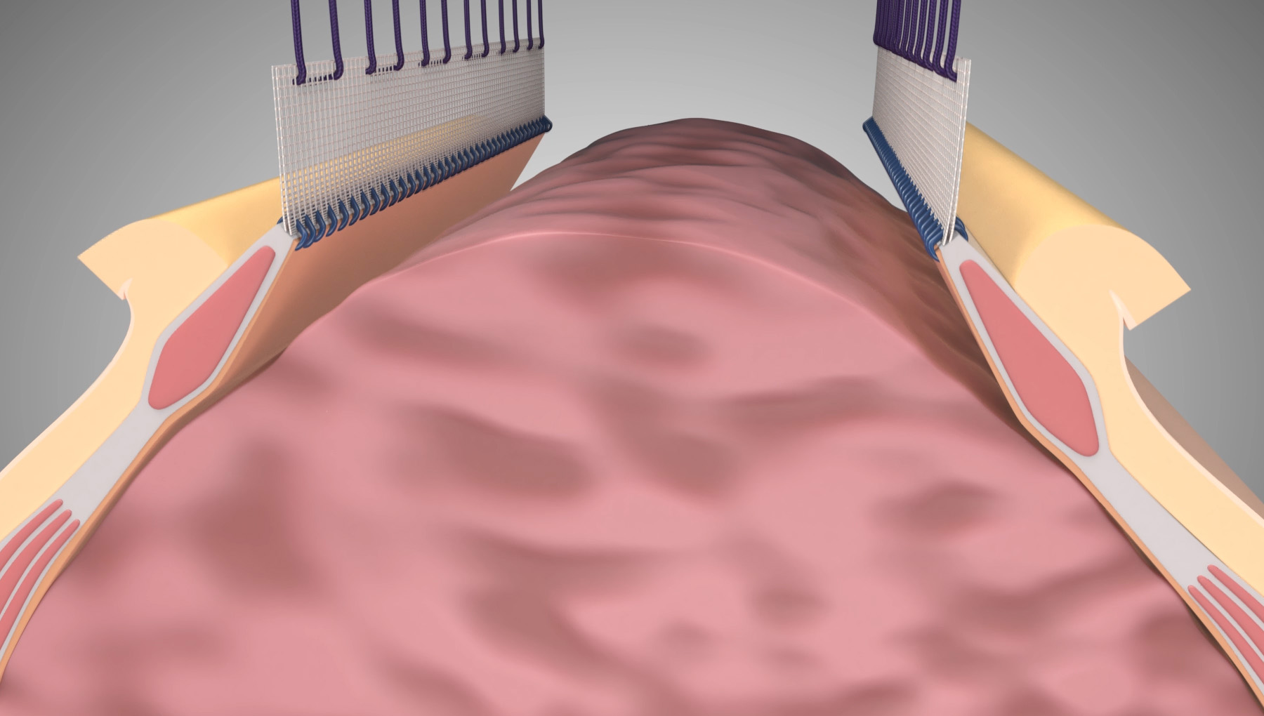 Header_Home_Hero_Traction
