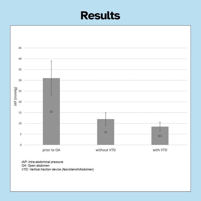Infographic_Abdomen_DohmenEN