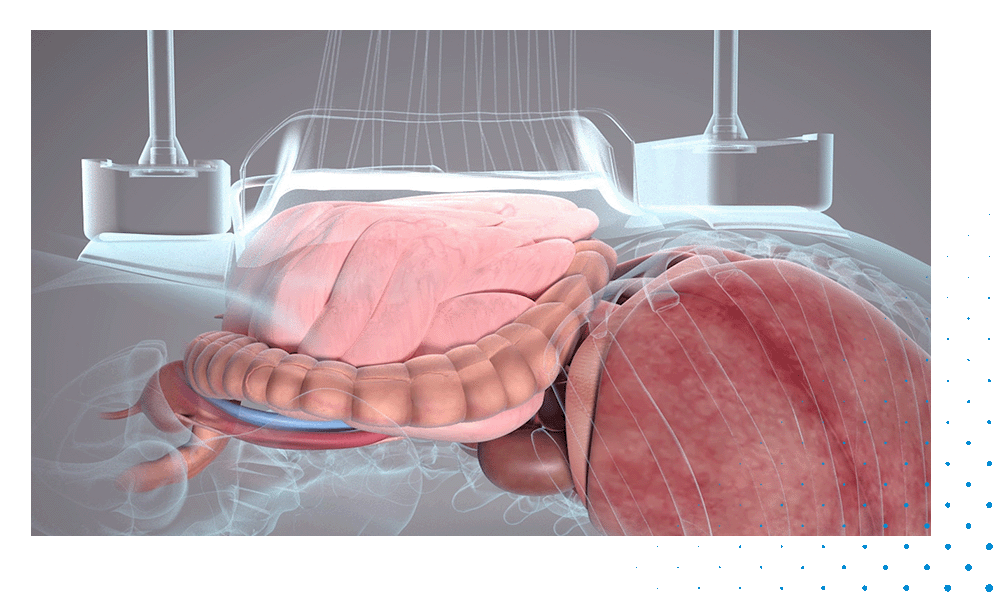 Solutions_Videopreview_Abdomen Animation_Pressure